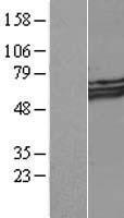 MYOC / Myocilin Protein - Western validation with an anti-DDK antibody * L: Control HEK293 lysate R: Over-expression lysate