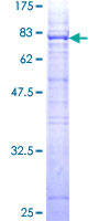 MYOC / Myocilin Protein - 12.5% SDS-PAGE of human MYOC stained with Coomassie Blue