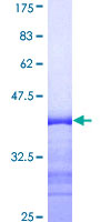 MYOC / Myocilin Protein - 12.5% SDS-PAGE Stained with Coomassie Blue.