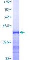 MYOC / Myocilin Protein - 12.5% SDS-PAGE Stained with Coomassie Blue.