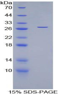MYOC / Myocilin Protein - Recombinant Myocilin By SDS-PAGE