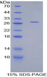MYOC / Myocilin Protein - Recombinant Myocilin By SDS-PAGE
