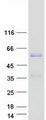 MYOC / Myocilin Protein - Purified recombinant protein MYOC was analyzed by SDS-PAGE gel and Coomassie Blue Staining