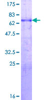 MYOD / MYOD1 Protein - 12.5% SDS-PAGE of human MYOD1 stained with Coomassie Blue
