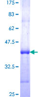 MYOF / Myoferlin Protein - 12.5% SDS-PAGE Stained with Coomassie Blue.