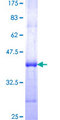 MYOF / Myoferlin Protein - 12.5% SDS-PAGE Stained with Coomassie Blue.