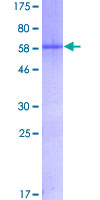 MYOG / Myogenin Protein - 12.5% SDS-PAGE of human MYOG stained with Coomassie Blue
