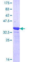 MYOM1 / Myomesin 1 Protein - 12.5% SDS-PAGE Stained with Coomassie Blue.