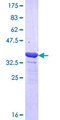 MYOM1 / Myomesin 1 Protein - 12.5% SDS-PAGE Stained with Coomassie Blue.