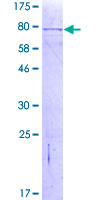 MYOT / Myotilin Protein - 12.5% SDS-PAGE of human MYOT stained with Coomassie Blue