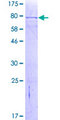 MYOT / Myotilin Protein - 12.5% SDS-PAGE of human MYOT stained with Coomassie Blue