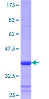 MYOT / Myotilin Protein - 12.5% SDS-PAGE Stained with Coomassie Blue.