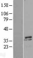 MYOZ2 / CS-1 Protein - Western validation with an anti-DDK antibody * L: Control HEK293 lysate R: Over-expression lysate