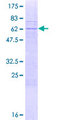 Myozenin / MYOZ1 Protein - 12.5% SDS-PAGE of human MYOZ1 stained with Coomassie Blue