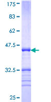 MYPN Protein - 12.5% SDS-PAGE Stained with Coomassie Blue.