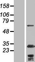 MYPT2 / PPP1R12B Protein - Western validation with an anti-DDK antibody * L: Control HEK293 lysate R: Over-expression lysate
