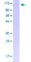 MYSM1 Protein - 12.5% SDS-PAGE of human MYSM1 stained with Coomassie Blue