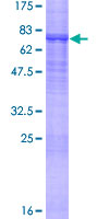 MYST1 Protein - 12.5% SDS-PAGE of human MYST1 stained with Coomassie Blue