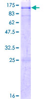 MYST2 / HBO1 Protein - 12.5% SDS-PAGE of human MYST2 stained with Coomassie Blue