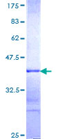 MYST3 / MOZ Protein - 12.5% SDS-PAGE Stained with Coomassie Blue.