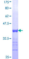 MYT1 Protein - 12.5% SDS-PAGE Stained with Coomassie Blue.