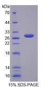MYT1 Protein - Recombinant Myelin Transcription Factor 1 (MYT1) by SDS-PAGE