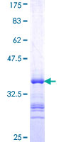 MZF / MZF1 Protein - 12.5% SDS-PAGE Stained with Coomassie Blue.