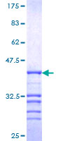 N-CoR / NCOR1 Protein - 12.5% SDS-PAGE Stained with Coomassie Blue.