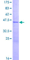 N4BP2L1 Protein - 12.5% SDS-PAGE of human CG018 stained with Coomassie Blue