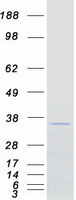 N4BP2L1 Protein - Purified recombinant protein N4BP2L1 was analyzed by SDS-PAGE gel and Coomassie Blue Staining