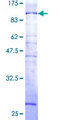 N4BP2L2 Protein - 12.5% SDS-PAGE of human PFAAP5 stained with Coomassie Blue