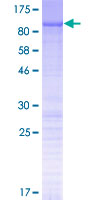 N4BP2L2 Protein - 12.5% SDS-PAGE of human N4BP2L2 stained with Coomassie Blue