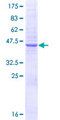N6AMT1 Protein - 12.5% SDS-PAGE of human HEMK2 stained with Coomassie Blue