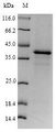 N6AMT1 Protein - (Tris-Glycine gel) Discontinuous SDS-PAGE (reduced) with 5% enrichment gel and 15% separation gel.