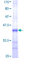 N6AMT1 Protein - 12.5% SDS-PAGE Stained with Coomassie Blue.