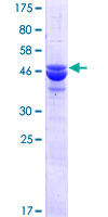 N6AMT2 Protein - 12.5% SDS-PAGE of human N6AMT2 stained with Coomassie Blue
