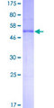 NAA10 / ARD1A Protein - 12.5% SDS-PAGE of human ARD1 stained with Coomassie Blue