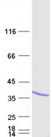NAA10 / ARD1A Protein - Purified recombinant protein NAA10 was analyzed by SDS-PAGE gel and Coomassie Blue Staining