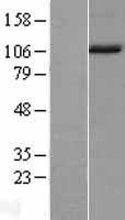 NAA16 / NARG1L Protein - Western validation with an anti-DDK antibody * L: Control HEK293 lysate R: Over-expression lysate