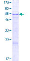NAA16 / NARG1L Protein - 12.5% SDS-PAGE of human NARG1L stained with Coomassie Blue