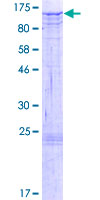 NAA25 Protein - 12.5% SDS-PAGE of human C12orf30 stained with Coomassie Blue