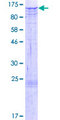 NAA25 Protein - 12.5% SDS-PAGE of human C12orf30 stained with Coomassie Blue