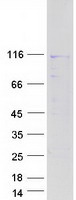 NAA25 Protein - Purified recombinant protein NAA25 was analyzed by SDS-PAGE gel and Coomassie Blue Staining