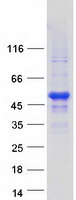 NAA30 Protein - Purified recombinant protein NAA30 was analyzed by SDS-PAGE gel and Coomassie Blue Staining