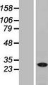 NAA40 Protein - Western validation with an anti-DDK antibody * L: Control HEK293 lysate R: Over-expression lysate