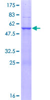NAA40 Protein - 12.5% SDS-PAGE of human NAT11 stained with Coomassie Blue