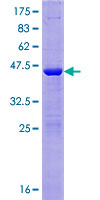 NAA50 / NAT13 / SAN Protein - 12.5% SDS-PAGE of human MAK3 stained with Coomassie Blue