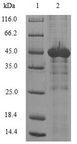 NAA50 / NAT13 / SAN Protein - (Tris-Glycine gel) Discontinuous SDS-PAGE (reduced) with 5% enrichment gel and 15% separation gel.