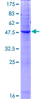 NAAA / ASAHL Protein - 12.5% SDS-PAGE of human NAAA stained with Coomassie Blue