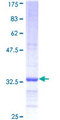 NAAA / ASAHL Protein - 12.5% SDS-PAGE Stained with Coomassie Blue.